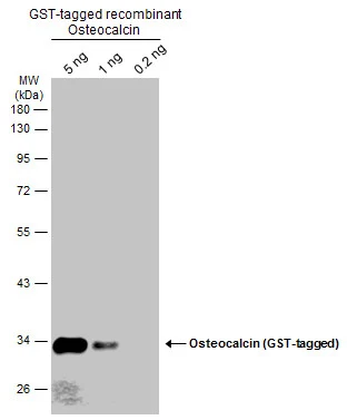 Recombinant Osteocalcin were separated by 10% SDS-PAGE, and the membrane was blotted with Osteocalcin antibody (GTX132703) diluted at 1:1000. The HRP-conjugated anti-rabbit IgG antibody (GTX213110-01) was used to detect the primary antibody.