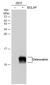 Non-transfected (–) and transfected (+) 293T whole cell extracts (30 μg) were separated by 15% SDS-PAGE, and the membrane was blotted with Osteocalcin antibody (GTX132703) diluted at 1:5000. The HRP-conjugated anti-rabbit IgG antibody (GTX213110-01) was used to detect the primary antibody.