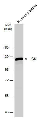 Human plasma (30 μg) was separated by 7.5% SDS-PAGE, and the membrane was blotted with C6 antibody (GTX132704) diluted at 1:1000. The HRP-conjugated anti-rabbit IgG antibody (GTX213110-01) was used to detect the primary antibody. Human plasma (30 μg) was separated by 7.5% SDS-PAGE, and the membrane was blotted with C6 antibody (GTX132704) diluted at 1:1000. The HRP-conjugated anti-rabbit IgG antibody (GTX213110-01) was used to detect the primary antibody.