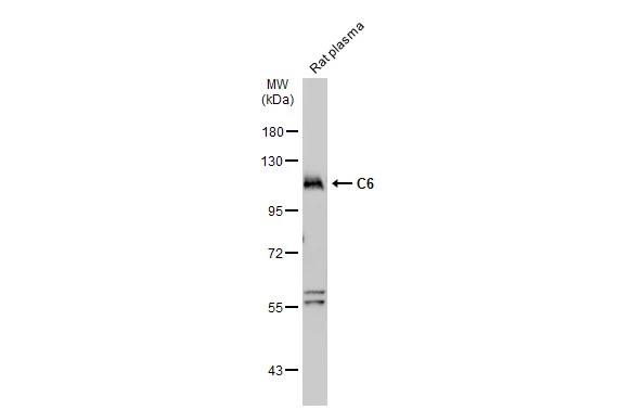 Rat plasma (50 μg) was separated by 7.5% SDS-PAGE, and the membrane was blotted with C6 antibody (GTX132704) diluted at 1:1000. The HRP-conjugated anti-rabbit IgG antibody (GTX213110-01) was used to detect the primary antibody, and the signal was developed with Trident ECL plus-Enhanced.