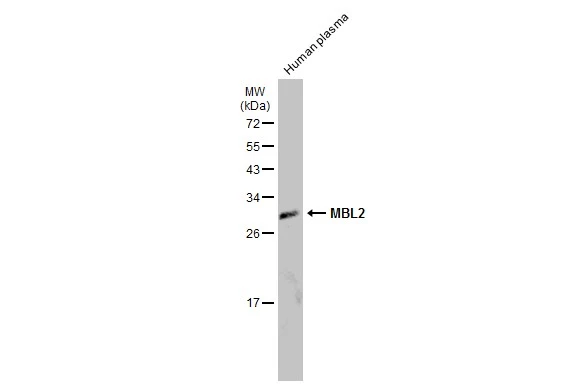 Human plasma (30 μg) was separated by 12% SDS-PAGE, and the membrane was blotted with MBL2 antibody (GTX132722) diluted at 1:1000. The HRP-conjugated anti-rabbit IgG antibody (GTX213110-01) was used to detect the primary antibody.