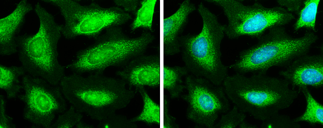 NDUFA9 antibody detects NDUFA9 protein at mitochondria by immunofluorescent analysis. Sample: HeLa cells were fixed in ice-cold MeOH for 5 min. Green: NDUFA9 stained by NDUFA9 antibody (GTX132726) diluted at 1:500. Blue: Hoechst 33342 staining.