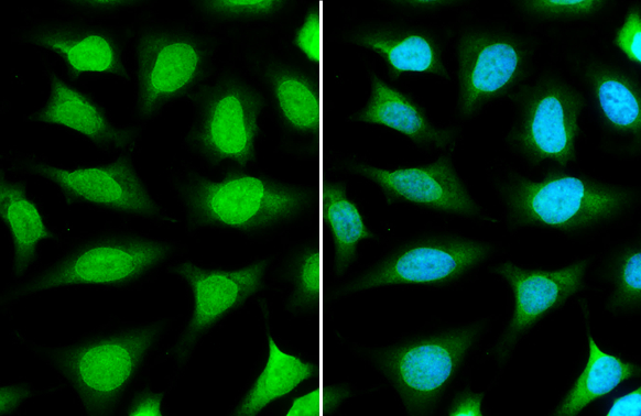 Nup153 antibody detects Nup153 protein at nuclear envelope and nucleus by immunofluorescent analysis. Sample: HeLa cells were fixed in 4% paraformaldehyde at RT for 15 min. Green: Nup153 stained by Nup153 antibody (GTX132731) diluted at 1:1000. Blue: Hoechst 33342 staining.