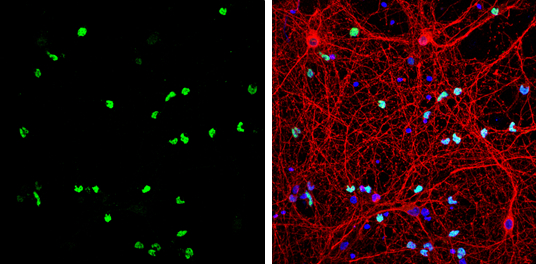 OLIG2 antibody detects OLIG2 protein by immunofluorescent analysis. Sample: DIV9 rat E18 primary cortical neurons and glia cells were fixed in 4% paraformaldehyde at RT for 15 min. Green: OLIG2 protein stained by OLIG2 antibody (GTX132732) diluted at 1:500. Red: beta Tubulin 3/ Tuj1, stained by beta Tubulin 3/ Tuj1 antibody [GT886] (GTX631830) diluted at 1:500. Blue: Fluoroshield with DAPI (GTX30920).
