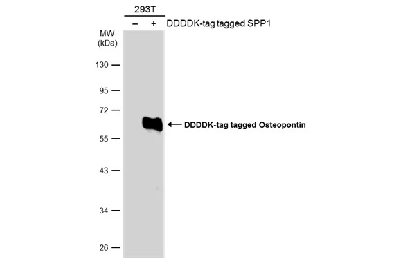 Non-transfected (–) and transfected (+) 293T whole cell extracts (30 μg) were separated by 10% SDS-PAGE, and the membrane was blotted with Osteopontin antibody (GTX132742) diluted at 1:5000. The HRP-conjugated anti-rabbit IgG antibody (GTX213110-01) was used to detect the primary antibody, and the signal was developed with Trident ECL plus-Enhanced. Non-transfected (–) and transfected (+) 293T whole cell extracts (30 μg) were separated by 10% SDS-PAGE, and the membrane was blotted with Osteopontin antibody (GTX132742) diluted at 1:5000. The HRP-conjugated anti-rabbit IgG antibody (GTX213110-01) was used to detect the primary antibody, and the signal was developed with Trident ECL plus-Enhanced.