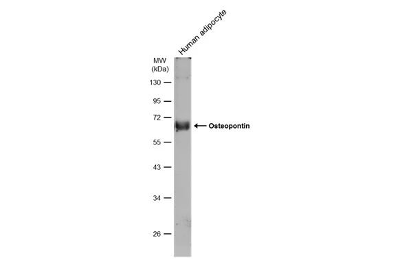 Human tissue extract (30 μg) was separated by 10% SDS-PAGE, and the membrane was blotted with Osteopontin antibody (GTX132742) diluted at 1:500. The HRP-conjugated anti-rabbit IgG antibody (GTX213110-01) was used to detect the primary antibody, and the signal was developed with Trident ECL plus-Enhanced.
