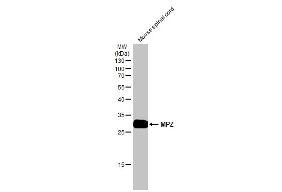 Mouse tissue extract (50 μg) was separated by 12% SDS-PAGE, and the membrane was blotted with MPZ antibody (GTX132747) diluted at 1:1000. The HRP-conjugated anti-rabbit IgG antibody (GTX213110-01) was used to detect the primary antibody.