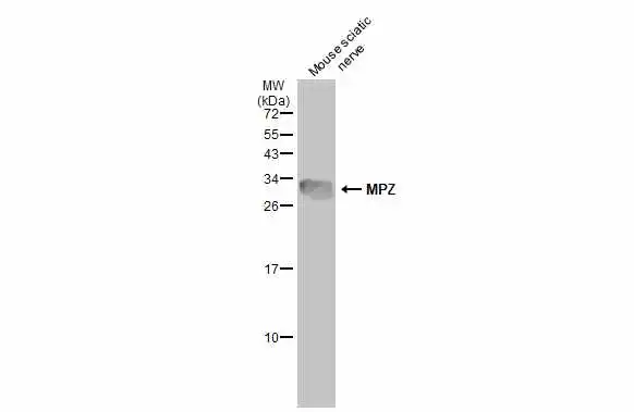 Mouse tissue extract (10 μg) was separated by 15% SDS-PAGE, and the membrane was blotted with MPZ antibody (GTX132747) diluted at 1:100000. The HRP-conjugated anti-rabbit IgG antibody (GTX213110-01) was used to detect the primary antibody.