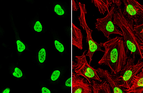 hnRNP L antibody detects hnRNP L protein at nucleus by immunofluorescent analysis. Sample: HeLa cells were fixed in 4% paraformaldehyde at RT for 15 min. Green: hnRNP L stained by hnRNP L antibody (GTX132754) diluted at 1:1000. Red: phalloidin, a cytoskeleton marker, diluted at 1:200.