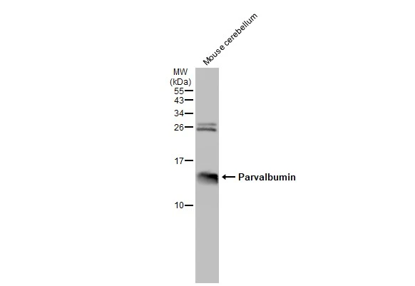 Mouse tissue extract (50 μg) was separated by 15% SDS-PAGE, and the membrane was blotted with Parvalbumin antibody (GTX132759) diluted at 1:2000. The HRP-conjugated anti-rabbit IgG antibody (GTX213110-01) was used to detect the primary antibody.