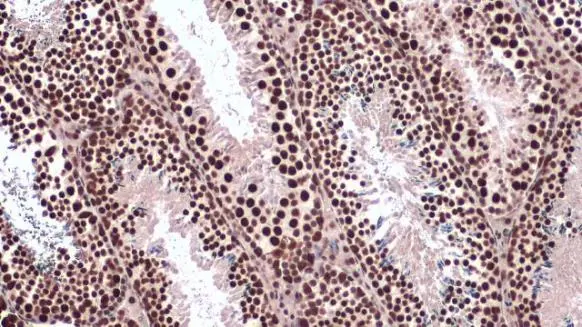 hnRNP L antibody