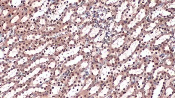 hnRNP L antibody