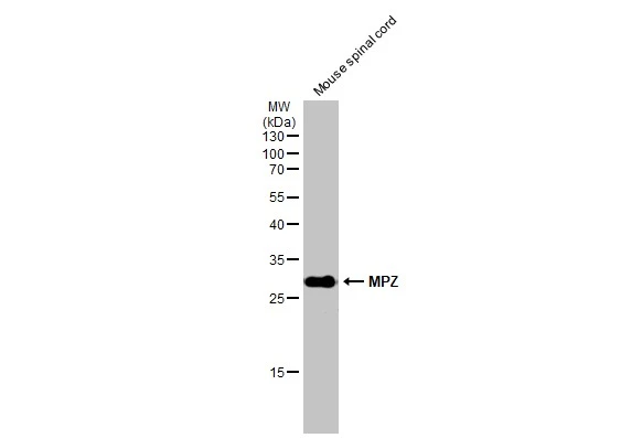 Mouse tissue extract (50 μg) was separated by 12% SDS-PAGE, and the membrane was blotted with MPZ antibody (GTX132761) diluted at 1:1000. The HRP-conjugated anti-rabbit IgG antibody (GTX213110-01) was used to detect the primary antibody.
