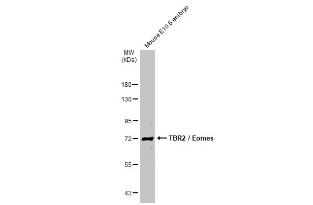 Mouse tissue extract (50 μg) was separated by 7.5% SDS-PAGE, and the membrane was blotted with TBR2 / Eomes antibody (GTX132776) diluted at 1:1000. The HRP-conjugated anti-rabbit IgG antibody (GTX213110-01) was used to detect the primary antibody.
