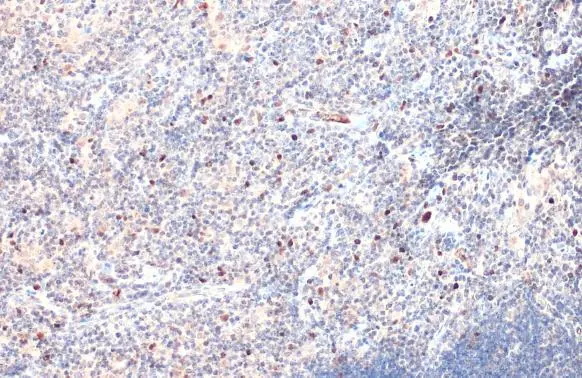 TBR2 / Eomes antibody detects TBR2 / Eomes protein at nucleus by immunohistochemical analysis. Sample: Paraffin-embedded mouse thymus gland. TBR2 / Eomes stained by TBR2 / Eomes antibody (GTX132776) diluted at 1:500. Antigen Retrieval: Citrate buffer, pH 6.0, 15 min