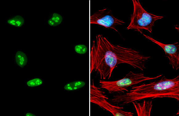 Nucleolin antibody detects Nucleolin protein at nucleolus by immunofluorescent analysis. Sample: HeLa cells were fixed in 4% paraformaldehyde at RT for 15 min. Green: Nucleolin stained by Nucleolin antibody (GTX132778) diluted at 1:1000. Red: phalloidin, a cytoskeleton marker, diluted at 1:200. Blue: Fluoroshield with DAPI (GTX30920).