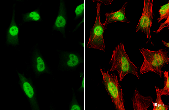TRF2 antibody detects TRF2 protein at nucleus by immunofluorescent analysis. Sample: HeLa cells were fixed in 4% paraformaldehyde at RT for 15 min. Green: TRF2 stained by TRF2 antibody (GTX132780) diluted at 1:500. Red: phalloidin, a cytoskeleton marker, diluted at 1:200. Scale bar= 10 μm.