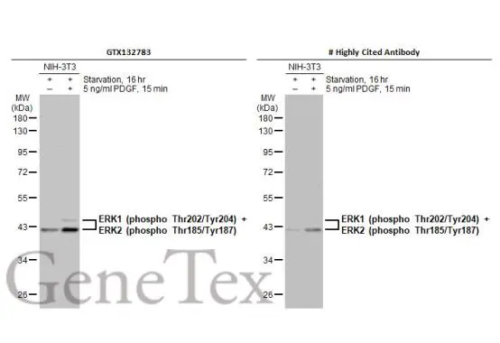 Untreated (–) and treated (+) NIH-3T3 whole cell extracts (30 μg) were separated by 10% SDS-PAGE, and the membranes were blotted with ERK1 (phospho Thr202/Tyr204) / ERK2 (phospho Thr185/Tyr187) antibody (GTX132783) diluted at 1:500 and competitor's antibody diluted at 1:500. The HRP-conjugated anti-rabbit IgG antibody (GTX213110-01) was used to detect the primary antibody. *The competitor is not affiliated with GeneTex and does not endorse this product.