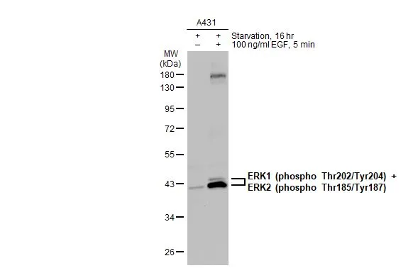 Untreated (–) and treated (+) A431 whole cell extracts (30 μg) were separated by 10% SDS-PAGE, and the membrane was blotted with ERK1 (phospho Thr202/Tyr204) / ERK2 (phospho Thr185/Tyr187) antibody (GTX132783) diluted at 1:500. The HRP-conjugated anti-rabbit IgG antibody (GTX213110-01) was used to detect the primary antibody.