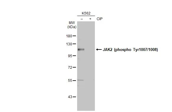 Untreated (–) and treated (+) K562 whole cell extracts (30 μg) were separated by 7.5% SDS-PAGE, and the membrane was blotted with JAK2 (phospho Tyr1007/1008) antibody (GTX132784) diluted at 1:1000. The HRP-conjugated anti-rabbit IgG antibody (GTX213110-01) was used to detect the primary antibody, and the signal was developed with Trident ECL plus-Enhanced.