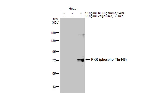 Untreated (–) and treated (+) HeLa whole cell extracts (30 μg) were separated by 7.5% SDS-PAGE, and the membrane was blotted with PKR (phospho Thr446) antibody (GTX132789) diluted at 1:500. The HRP-conjugated anti-rabbit IgG antibody (GTX213110-01) was used to detect the primary antibody, and the signal was developed with Trident ECL plus-Enhanced.