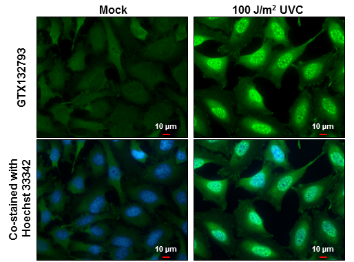 DNA-PKcs (phospho Ser2056) antibody detects DNA-PKcs (phospho Ser2056) protein at cytoplasm and nucleus by immunofluorescent analysis. Sample: Mock and treated HeLa cells were fixed in 4% paraformaldehyde at RT for 15 min. Green: DNA-PKcs (phospho Ser2056) stained by DNA-PKcs (phospho Ser2056) antibody (GTX132793) diluted at 1:500. Blue: Hoechst 33342 staining. Scale bar= 10 μm.