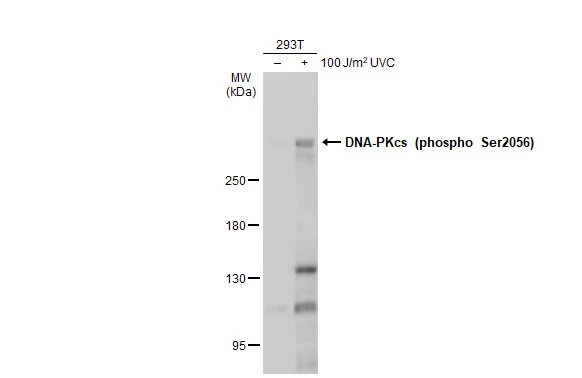 Untreated (–) and treated (+) 293T whole cell extracts (60 μg) were separated by 5% SDS-PAGE, and the membrane was blotted with DNA-PKcs (phospho Ser2056) antibody (GTX132793) diluted at 1:500. The HRP-conjugated anti-rabbit IgG antibody (GTX213110-01) was used to detect the primary antibody.