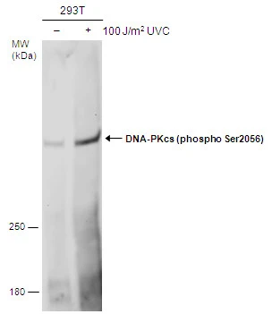Untreated (–) and treated (+) 293T whole cell extracts (60 μg) were separated by 5% SDS-PAGE, and the membrane was blotted with DNA-PKcs (phospho Ser2056) antibody (GTX132794) diluted at 1:500.