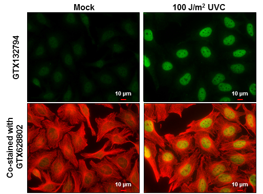 DNA-PKcs (phospho Ser2056) antibody detects DNA-PKcs (phospho Ser2056) protein at nucleus by immunofluorescent analysis. Sample: Mock and treated HeLa cells were fixed in 4% paraformaldehyde at RT for 15 min. Green: DNA-PKcs (phospho Ser2056) stained by DNA-PKcs (phospho Ser2056) antibody (GTX132794) diluted at 1:500. Red: alpha Tubulin, a cytoskeleton marker, stained by alpha Tubulin antibody [GT114] (GTX628802) diluted at 1:500. Scale bar= 10 μm.