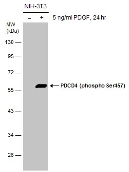 Untreated (–) and treated (+) NIH-3T3 whole cell extracts (30 μg) were separated by 10% SDS-PAGE, and the membrane was blotted with PDCD4 (phospho Ser457) antibody (GTX132798) diluted at 1:1000.