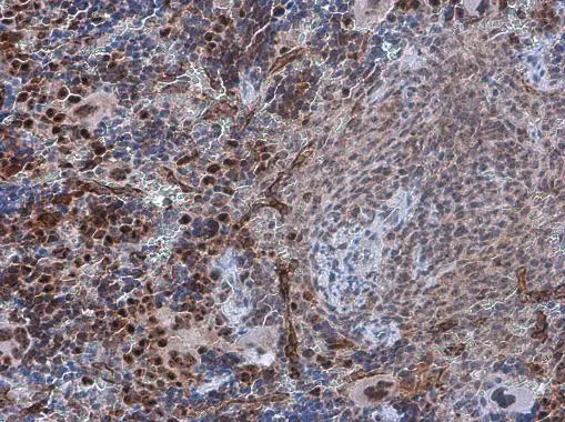 PDCD4 (phospho Ser457) antibody detects PDCD4 (phospho Ser457) protein at nucleus in mouse spleen by immunohistochemical analysis. Sample: Paraffin-embedded mouse spleen. PDCD4 (phospho Ser457) antibody (GTX132798) diluted at 1:500. 
 Antigen Retrieval: Citrate buffer, pH 6.0, 15 min