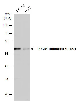 Various whole cell extracts (30 μg) were separated by 10% SDS-PAGE, and the membrane was blotted with PDCD4 (phospho Ser457) antibody (GTX132798) diluted at 1:500. The HRP-conjugated anti-rabbit IgG antibody (GTX213110-01) was used to detect the primary antibody.