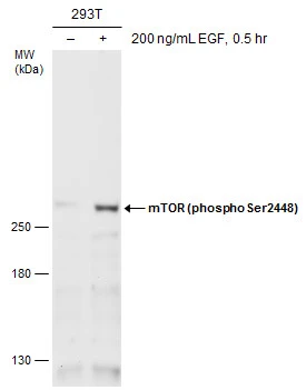 Anti-mTOR (phospho Ser2448) antibody (GTX132803) | GeneTex