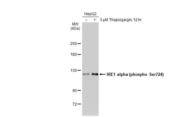 Untreated (–) and treated (+) HepG2 whole cell extracts (30 μg) were separated by 5% SDS-PAGE, and the membrane was blotted with IRE1 alpha (phospho Ser724) antibody (GTX132808) diluted at 1:1000. The HRP-conjugated anti-rabbit IgG antibody (GTX213110-01) was used to detect the primary antibody. Untreated (–) and treated (+) HepG2 whole cell extracts (30 μg) were separated by 5% SDS-PAGE, and the membrane was blotted with IRE1 alpha (phospho Ser724) antibody (GTX132808) diluted at 1:1000. The HRP-conjugated anti-rabbit IgG antibody (GTX213110-01) was used to detect the primary antibody.