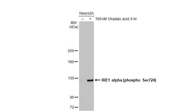 Untreated (–) and treated (+) Neuro2A whole cell extract (30 μg) were separated by 5% SDS-PAGE, and the membrane was blotted with IRE1 alpha (phospho Ser724) antibody (GTX132808) diluted at 1:1000. The HRP-conjugated anti-rabbit IgG antibody (GTX213110-01) was used to detect the primary antibody, and the signal was developed with Trident ECL plus-Enhanced. Untreated (–) and treated (+) Neuro2A whole cell extract (30 μg) were separated by 5% SDS-PAGE, and the membrane was blotted with IRE1 alpha (phospho Ser724) antibody (GTX132808) diluted at 1:1000. The HRP-conjugated anti-rabbit IgG antibody (GTX213110-01) was used to detect the primary antibody, and the signal was developed with Trident ECL plus-Enhanced.