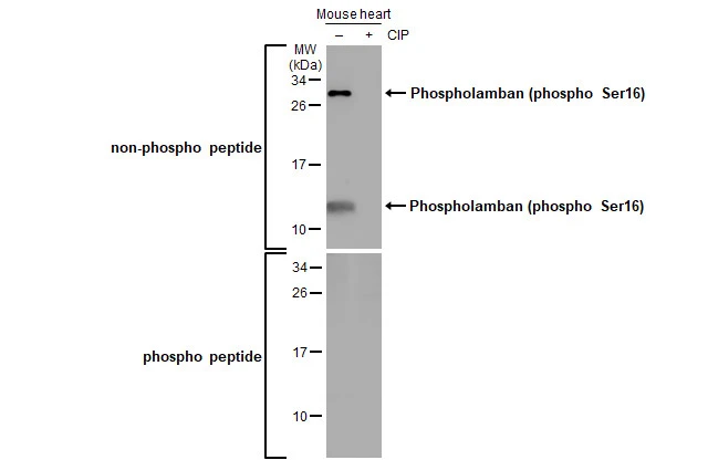 Untreated (–) and treated (+) Mouse tissue extract (50 μg) were separated by 15% SDS-PAGE, and the membrane was blotted with Phospholamban (phospho Ser16) antibody (GTX132818) diluted at 1:1000. The HRP-conjugated anti-rabbit IgG antibody (GTX213110-01) was used to detect the primary antibody.