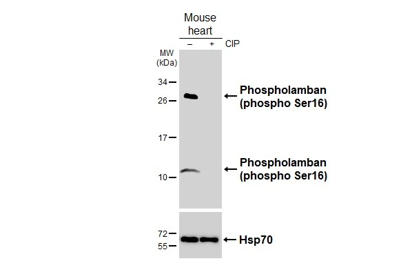 Untreated (–) and treated (+) mouse tissue extracts (50 μg) were separated by 15% SDS-PAGE, and the membrane was blotted with Phospholamban (phospho Ser16) antibody (GTX132818) diluted at 1:1000. The HRP-conjugated anti-rabbit IgG antibody (GTX213110-01) was used to detect the primary antibody.