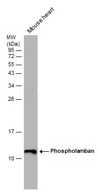 Mouse tissue extract (50 μg) was separated by 15% SDS-PAGE, and the membrane was blotted with Phospholamban antibody (GTX132854) diluted at 1:1000.
