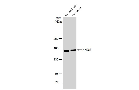 Various tissue extracts (50 μg) were separated by 5% SDS-PAGE, and the membrane was blotted with nNOS antibody (GTX132857) diluted at 1:1000. The HRP-conjugated anti-rabbit IgG antibody (GTX213110-01) was used to detect the primary antibody.