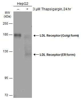 Untreated (–) and treated (+) HepG2 whole cell extracts (60 μg) were separated by 7.5% SDS-PAGE, and the membrane was blotted with LDL Receptor antibody (GTX132860) diluted at 1:1000. The HRP-conjugated anti-rabbit IgG antibody (GTX213110-01) was used to detect the primary antibody.