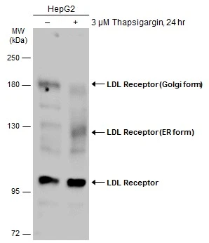 Untreated (–) and treated (+) HepG2 whole cell extracts (60 μg) were separated by 7.5% SDS-PAGE, and the membrane was blotted with LDL Receptor antibody (GTX132861) diluted at 1:1000. The HRP-conjugated anti-rabbit IgG antibody (GTX213110-01) was used to detect the primary antibody.