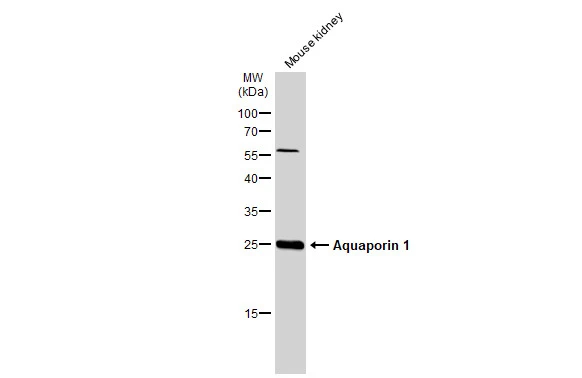 Mouse tissue extract (50 μg) was separated by 12% SDS-PAGE, and the membrane was blotted with Aquaporin 1 antibody (GTX132870) diluted at 1:1000. The HRP-conjugated anti-rabbit IgG antibody (GTX213110-01) was used to detect the primary antibody.