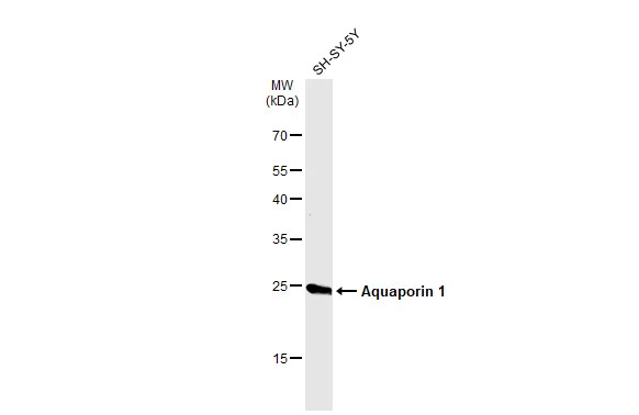 Whole cell extract (30 μg) was separated by 12% SDS-PAGE, and the membrane was blotted with Aquaporin 1 antibody (GTX132870) diluted at 1:1000. The HRP-conjugated anti-rabbit IgG antibody (GTX213110-01) was used to detect the primary antibody.