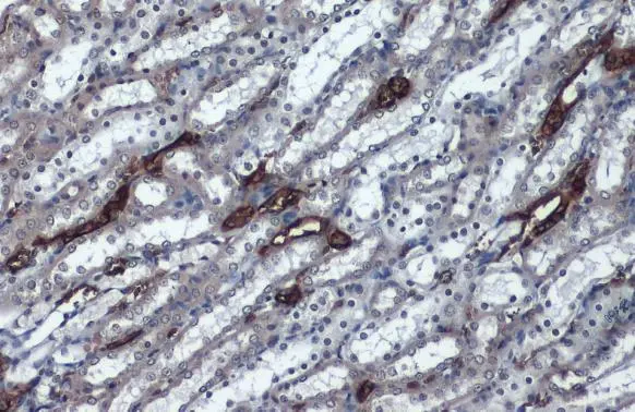 Aquaporin 1 antibody detects Aquaporin 1 protein at cell membrane and cytoplasm by immunohistochemical analysis. Sample: Paraffin-embedded rat kidney. Aquaporin 1 stained by Aquaporin 1 antibody (GTX132870) diluted at 1:1000. Antigen Retrieval: Citrate buffer, pH 6.0, 15 min