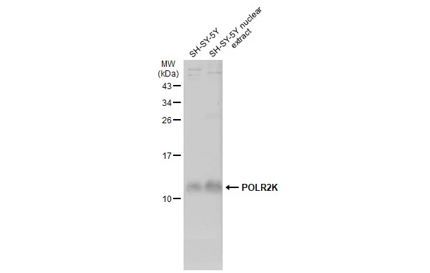 SH-SY5Y whole cell and nuclear extracts (30 μg) were separated by 15% SDS-PAGE, and the membrane was blotted with POLR2K antibody (GTX132871) diluted at 1:1000. The HRP-conjugated anti-rabbit IgG antibody (GTX213110-01) was used to detect the primary antibody, and the signal was developed with Trident ECL plus-Enhanced.