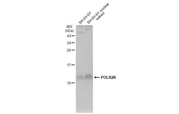 SH-SY5Y whole cell and nuclear extracts (30 μg) were separated by 15% SDS-PAGE, and the membrane was blotted with POLR2K antibody (GTX132872) diluted at 1:1000. The HRP-conjugated anti-rabbit IgG antibody (GTX213110-01) was used to detect the primary antibody, and the signal was developed with Trident ECL plus-Enhanced.