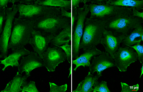 CD59 antibody detects CD59 protein at cell membrane and secreted by immunofluorescent analysis. Sample: HeLa cells were fixed in 4% paraformaldehyde at RT for 15 min. Green: CD59 stained by CD59 antibody (GTX132874) diluted at 1:500. Blue: Fluoroshield with DAPI (GTX30920). Scale bar= 10 μm.