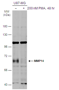 Untreated (–) and treated (+) U87-MG whole cell extracts (30 μg) were separated by 7.5% SDS-PAGE, and the membrane was blotted with MMP14 antibody (GTX132884) diluted at 1:1000. The HRP-conjugated anti-rabbit IgG antibody (GTX213110-01) was used to detect the primary antibody, and the signal was developed with Trident ECL plus-Enhanced.