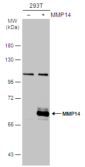 Non-transfected (–) and transfected (+) 293T whole cell extracts (30 μg) were separated by 7.5% SDS-PAGE, and the membrane was blotted with MMP14 antibody (GTX132884) diluted at 1:1000. The HRP-conjugated anti-rabbit IgG antibody (GTX213110-01) was used to detect the primary antibody.