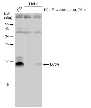 RD and untreated (–) or treated (+) HeLa whole cell extracts (30 μg) were separated by 15% SDS-PAGE, and the membrane was blotted with LC3A antibody (GTX132889) diluted at 1:1000.
